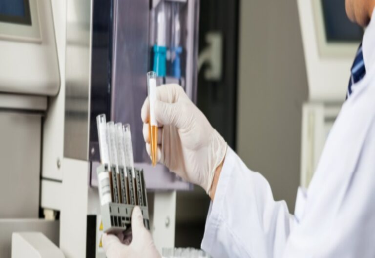 Lab technician checking the samples.