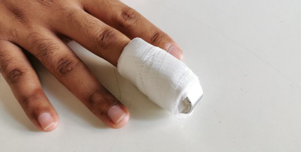 Finger Fracture