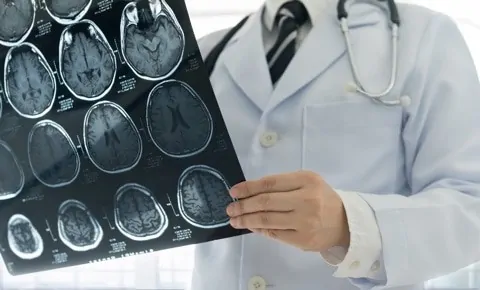 A doctor holds a CT scan in an emergency room in Houston, TX