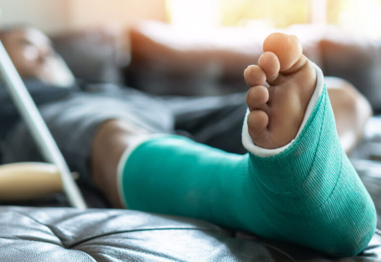 A man's ankle cast that he got at an emergency room in Houston, TX