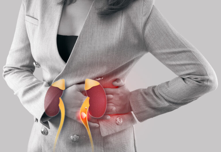 photo of a woman holding her side with a graphic of kidneys on top of it