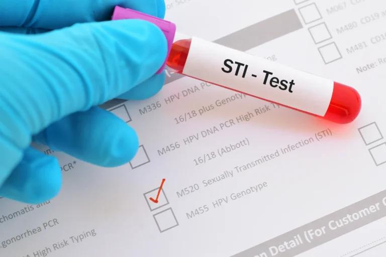 A gloved hand holding an STI test in Houston, TX