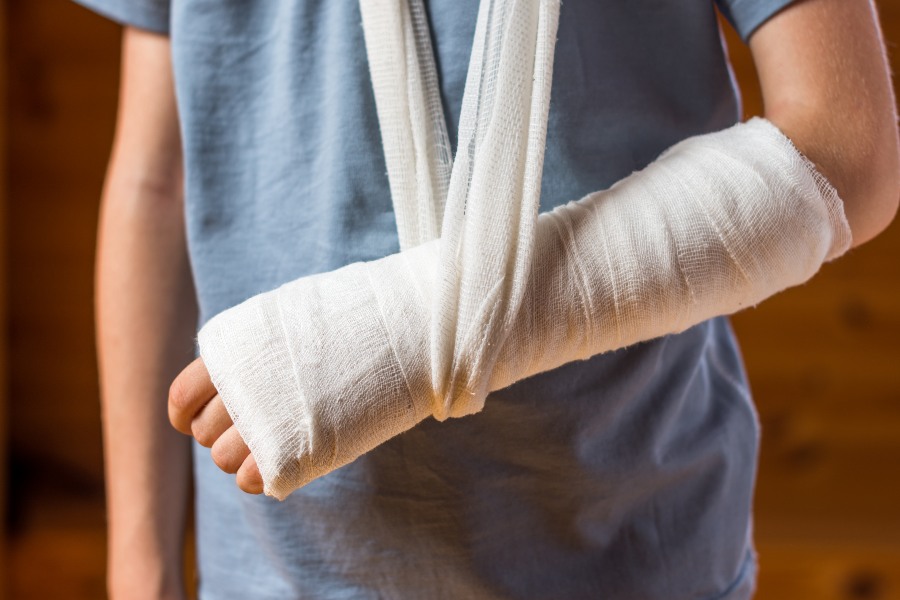 A close-up image of a patient with a fractured wrist in Houston, TX